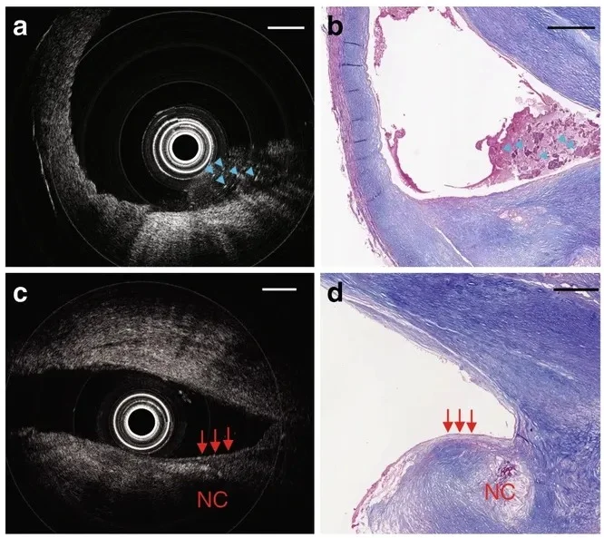 Супер -тонка камера розвивається менше, ніж волосся людини